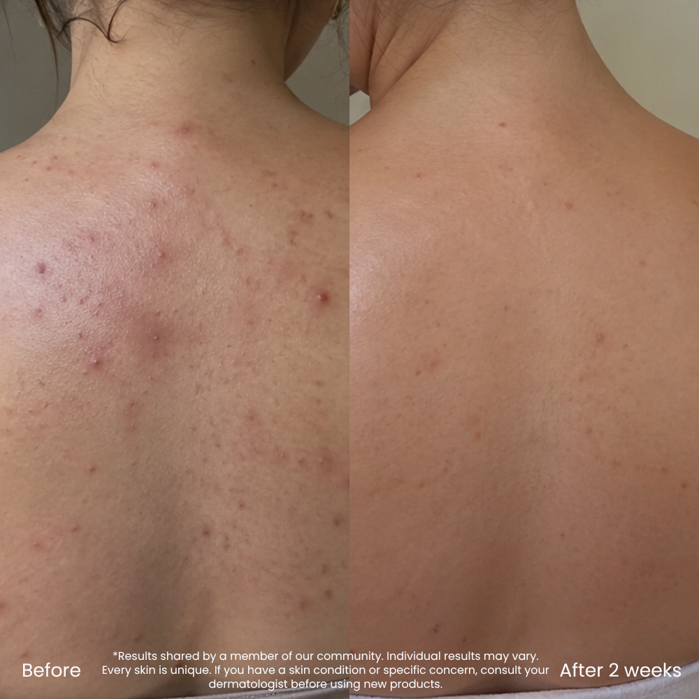 Hyaluronzuur Hydraterende Bodylotion Voor De Droge Huid
