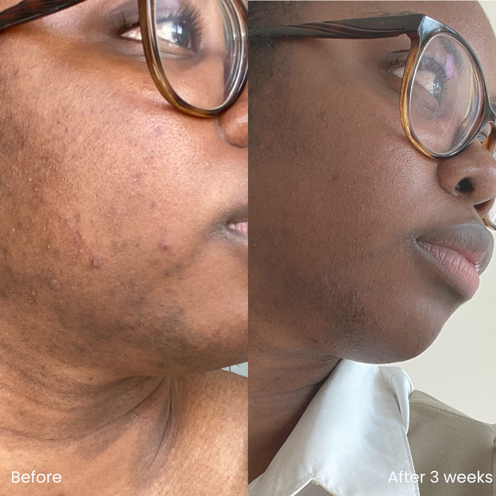 Anti-aging retinol serum