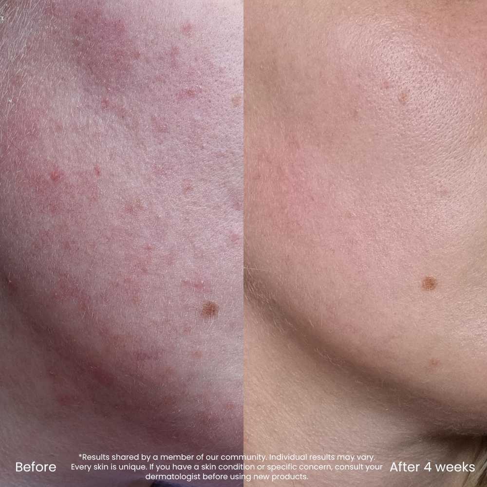 Dark Spot & Redness Correcting Vitamin C Serum