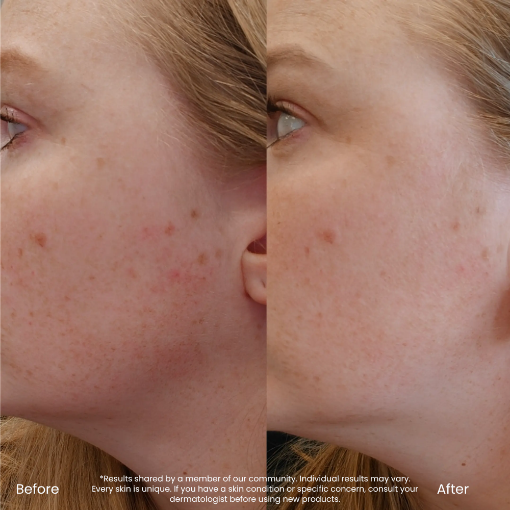 Onzichtbare Hydraterende SPF
