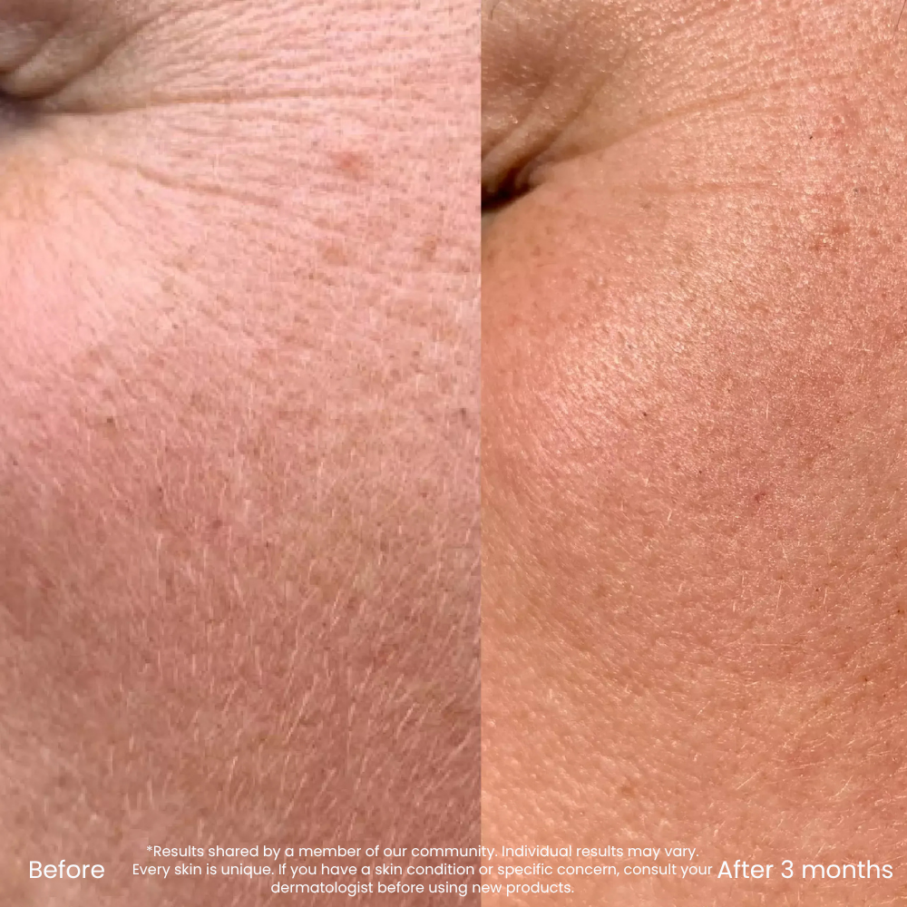 0,3% Retinol Serum Voor Fijne Lijntjes & Oneffen Huidtextuur