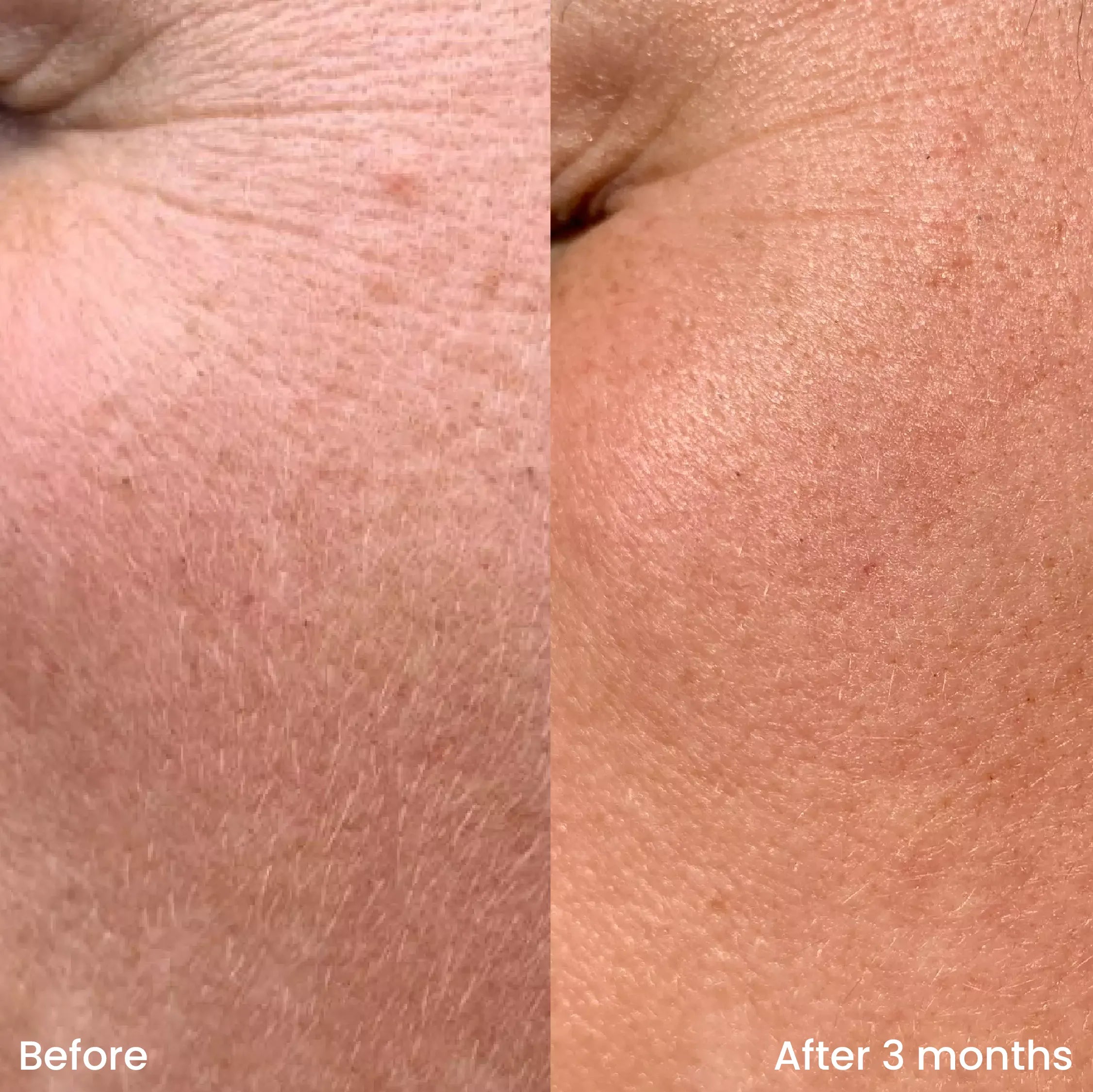 Retinol night serum