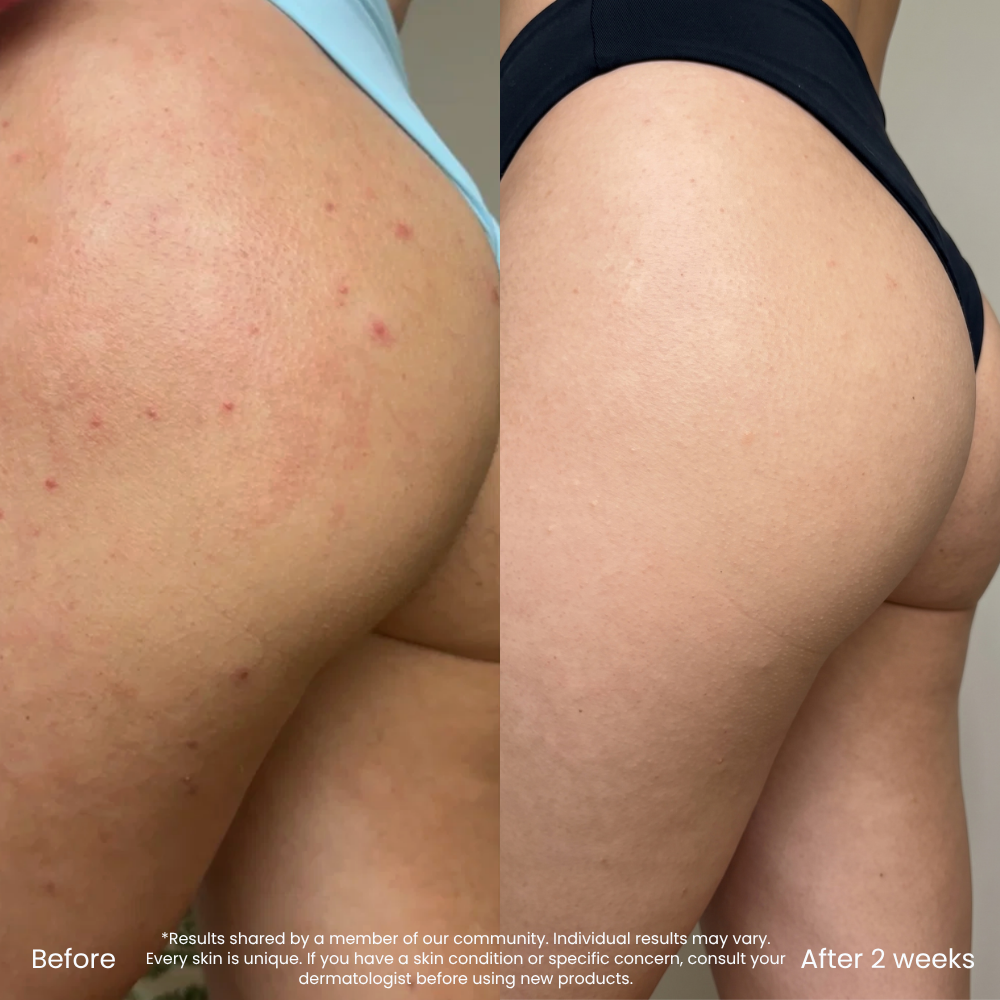 Hyaluronzuur Hydraterende Bodylotion Voor De Droge Huid